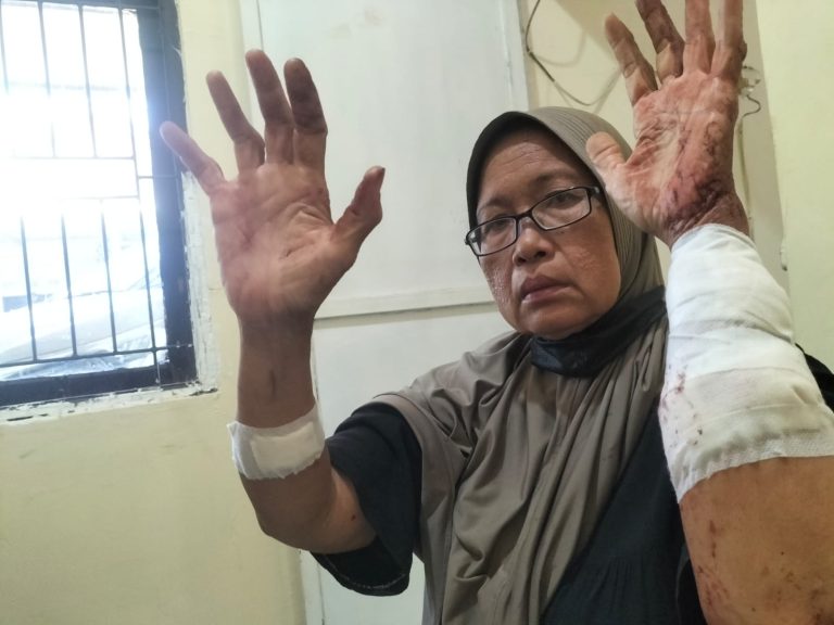 Sengketa Lahan Indramayu Memanas, Kakak Kandung Diduga Aniaya Adik Hingga Tangan Robek 17 Jahitan