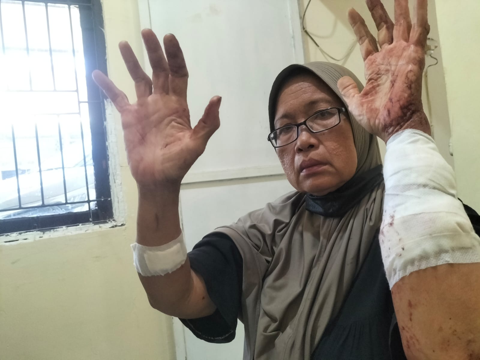 Sengketa Lahan Indramayu Memanas, Kakak Kandung Diduga Aniaya Adik Hingga Tangan Robek 17 Jahitan
